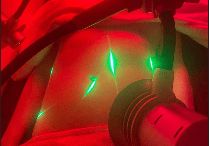 Belly And Waist (10 Sessions Package)